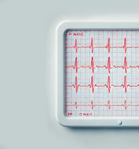 a generated EKG score