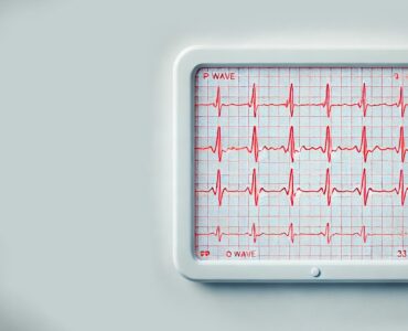 a generated EKG score